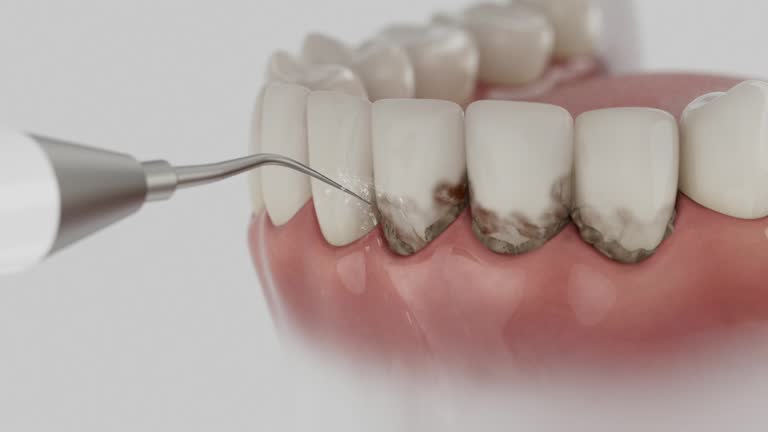 Trusted Teeth Cleaning And Checkup service in Anton, TX - Dentist Open Now